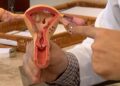 Conheça os sintomas da endometriose e saiba como tratar a doença