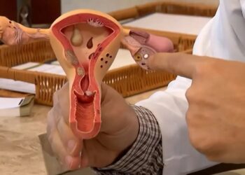 Conheça os sintomas da endometriose e saiba como tratar a doença