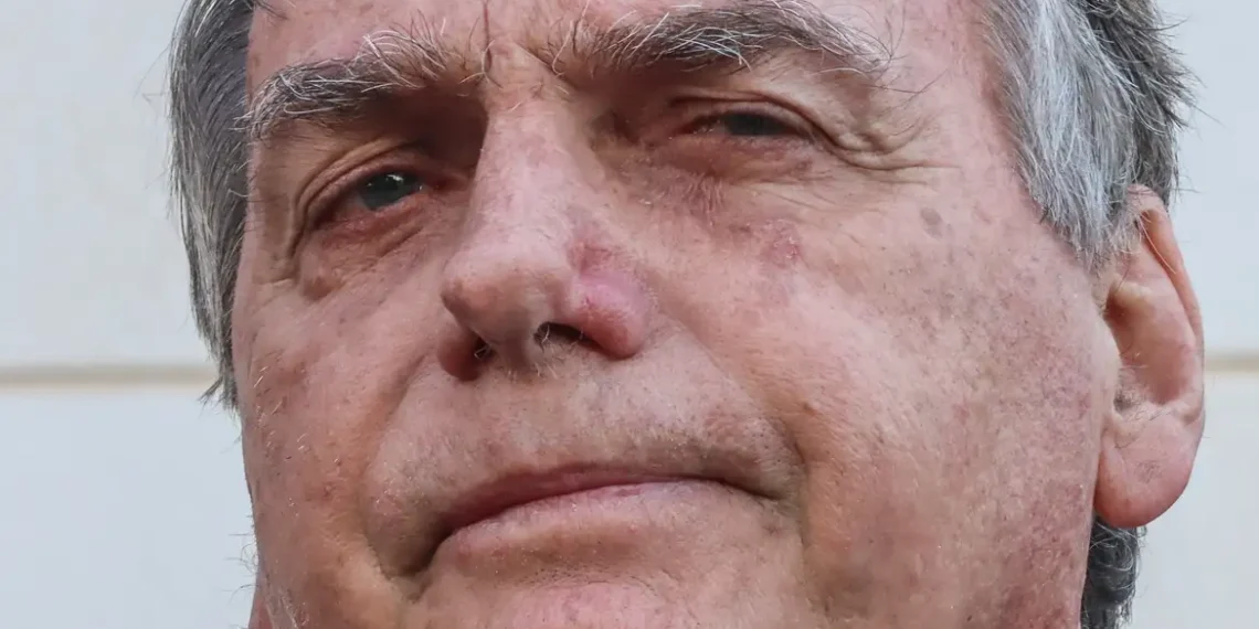 Bolsonaro tem piora clínica e segue na UTI após cirurgia abdominal