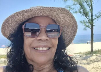 Vilma Nascimento abre o jogo sobre sua luta contra o Melasma