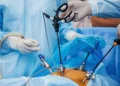 Nova resolução do CFM amplia acesso à cirurgia bariátrica no Brasil