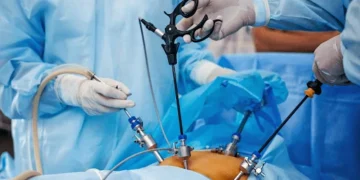 Nova resolução do CFM amplia acesso à cirurgia bariátrica no Brasil