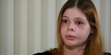 Médica agredida por namorado fisiculturista relata sequelas após tentativa de feminicídio