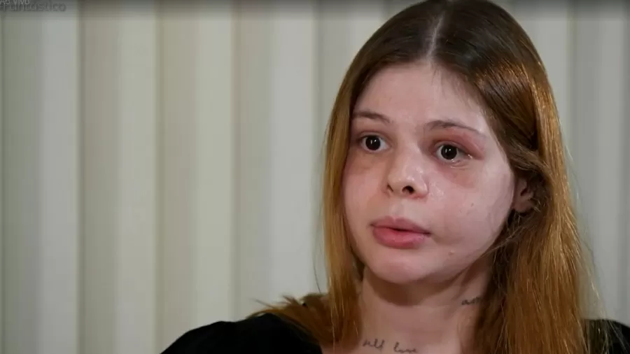 Médica agredida por namorado fisiculturista relata sequelas após tentativa de feminicídio