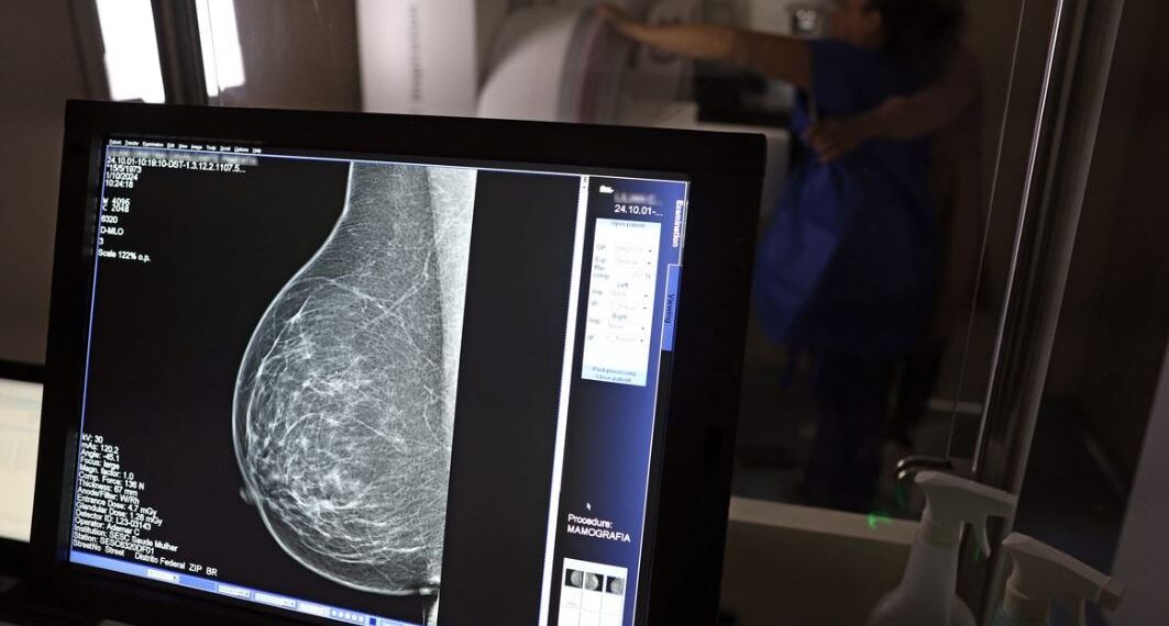 Ministério da Saúde passa a recomendar mamografia a partir dos 40 anos