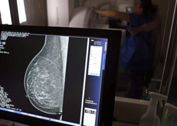 Ministério da Saúde passa a recomendar mamografia a partir dos 40 anos