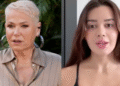 Xuxa e Franciny expõem luta contra alopecia e ampliam debate sobre queda de cabelo em mulheres
