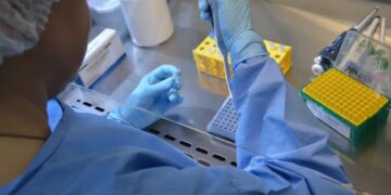 País tem 17 casos confirmados de intoxicação por metanol