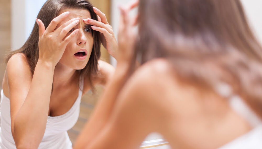 Ciclo menstrual irregular aumenta risco de acne, melasma e manchas na pele, aponta estudo