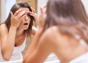 Ciclo menstrual irregular aumenta risco de acne, melasma e manchas na pele, aponta estudo