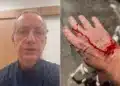 José Roberto Burnier é atacado por pitbull sem guia em São Paulo