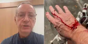José Roberto Burnier é atacado por pitbull sem guia em São Paulo